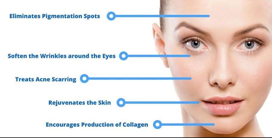 microneedling benefits image